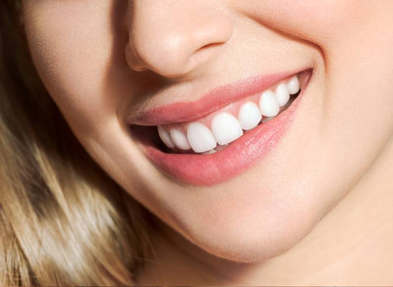 ダイレクトボンディング